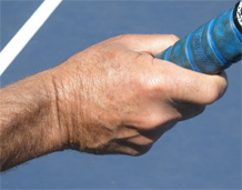 Figure from The Classic Forehand Volley